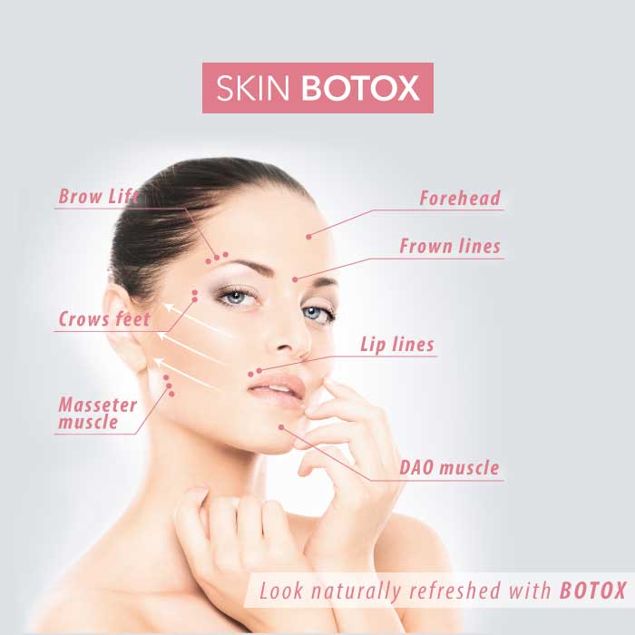 Skin botox