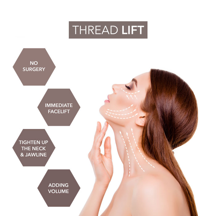 Thread lift