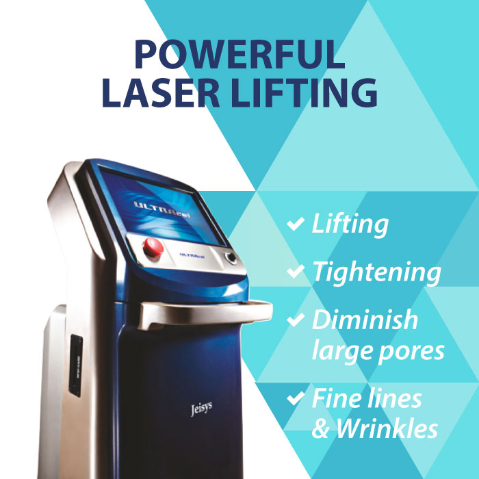 Ultracel lifting laser